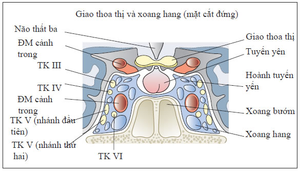 Phình động mạch xoang hang - Hình ảnh minh họa